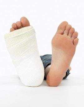 broken-foot